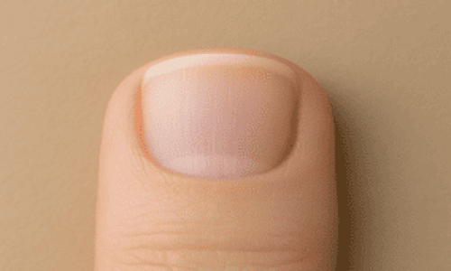 Esta imagen muestra de forma clara y detallada la anatomía de las uñas. Se observa un primer plano de un dedo pulgar, donde se puede apreciar la estructura natural de la uña humana. La anatomía de las uñas incluye la lámina ungueal bien formada, la lunula en la base de la uña (ligeramente más clara), el eponiquio (cutícula), y el borde libre. El fondo neutro resalta las distintas partes de la uña, haciendo que cada detalle de la anatomía de las uñas sea más visible y fácil de identificar. Esta imagen es ideal para contenidos educativos o informativos sobre el cuidado de las uñas.









